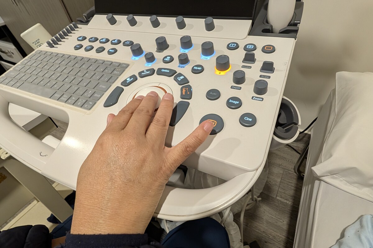 Detalle de las manos de la doctora sobre la consola del equipo de ultrasonido